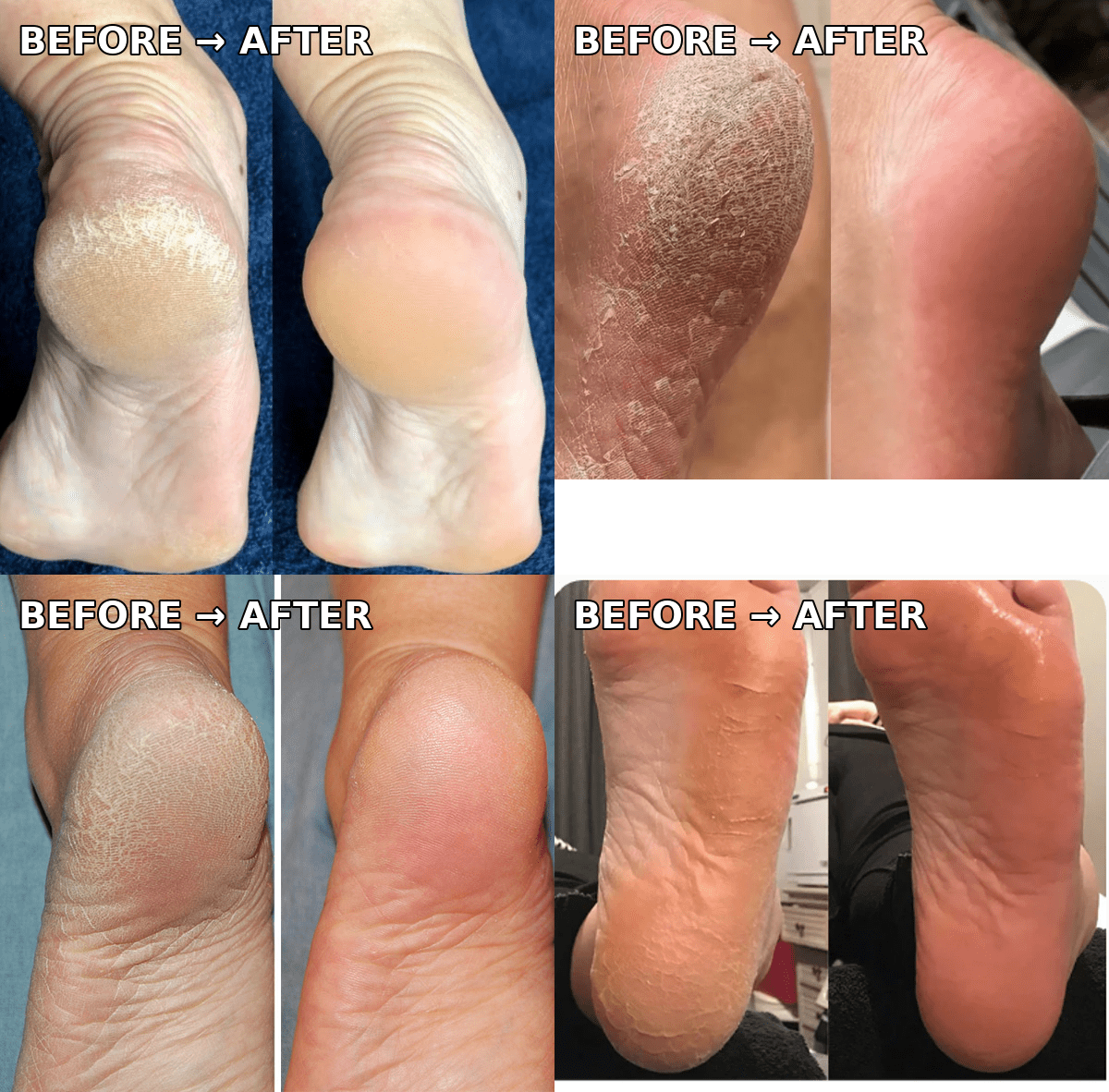 Electric Pedicure Foot File & Callus Remover - Ajman