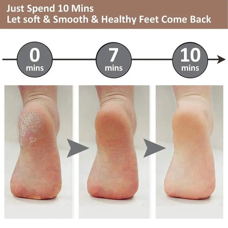 Electric Pedicure Foot File & Callus Remover - Ajman